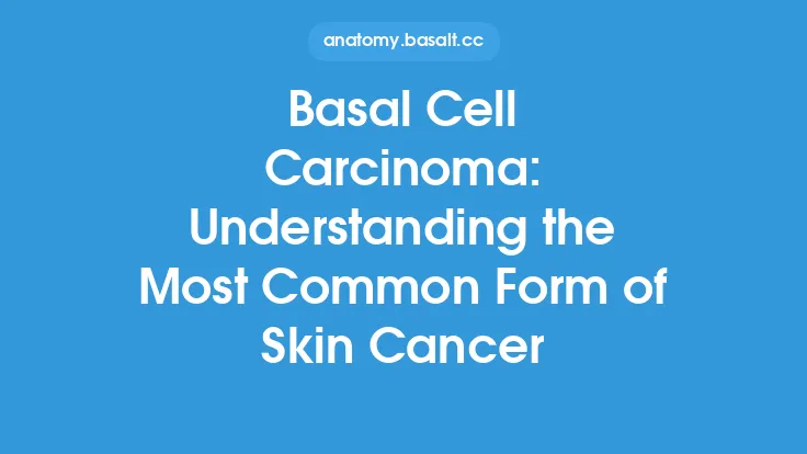 Basal Cell Carcinoma: Understanding the Most Common Form of Skin Cancer Thumbnail