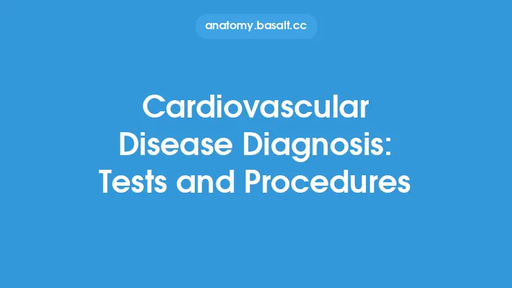 Cardiovascular Disease Diagnosis: Tests and Procedures Thumbnail