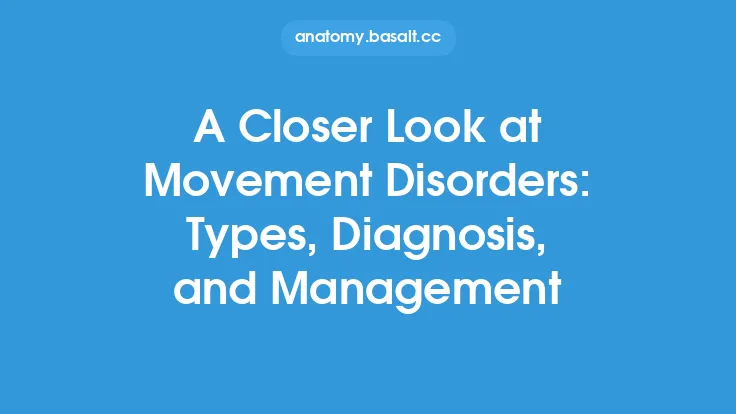 A Closer Look at Movement Disorders: Types, Diagnosis, and Management Thumbnail