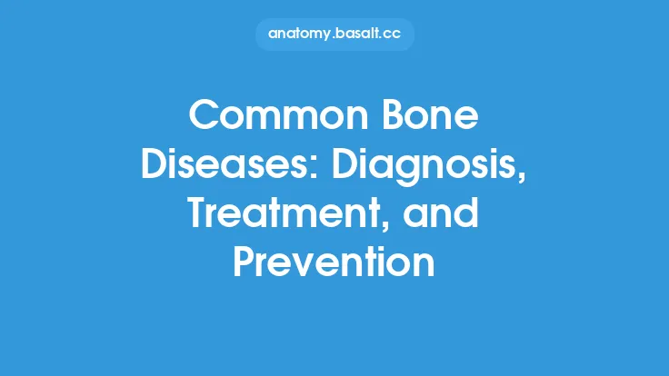 Common Bone Diseases: Diagnosis, Treatment, and Prevention Thumbnail