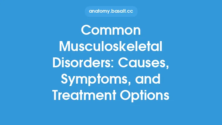 Common Musculoskeletal Disorders: Causes, Symptoms, and Treatment Options Thumbnail