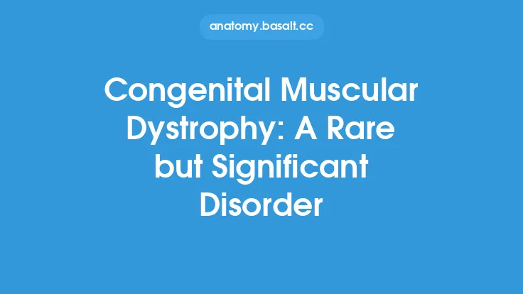 Congenital Muscular Dystrophy: A Rare but Significant Disorder Thumbnail