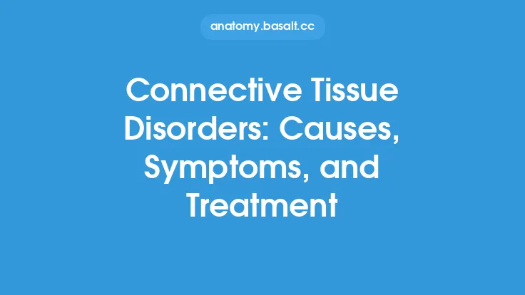 Connective Tissue Disorders: Causes, Symptoms, and Treatment Thumbnail
