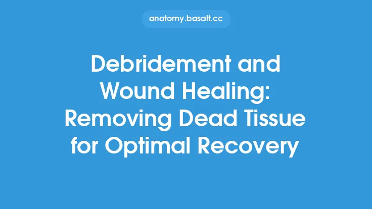 Debridement and Wound Healing: Removing Dead Tissue for Optimal Recovery Thumbnail