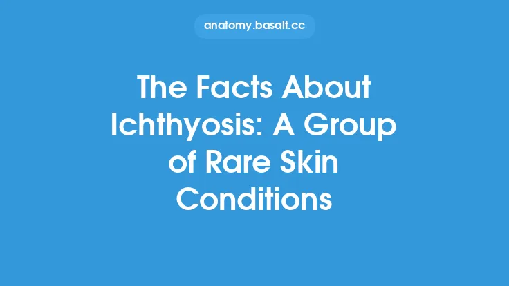 The Facts About Ichthyosis: A Group of Rare Skin Conditions Thumbnail