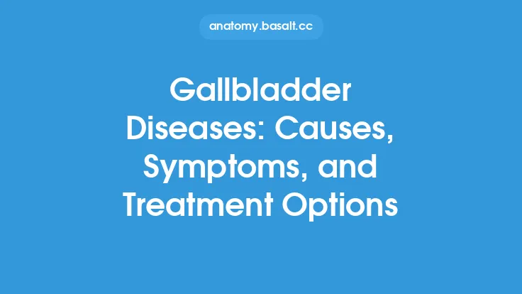 Gallbladder Diseases: Causes, Symptoms, and Treatment Options Thumbnail