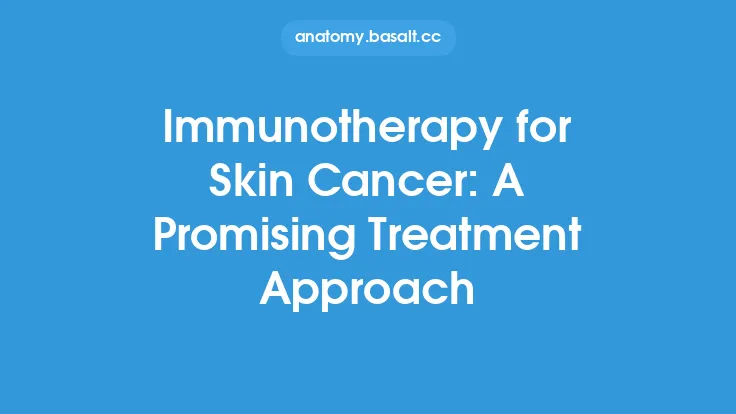 Immunotherapy for Skin Cancer: A Promising Treatment Approach Thumbnail