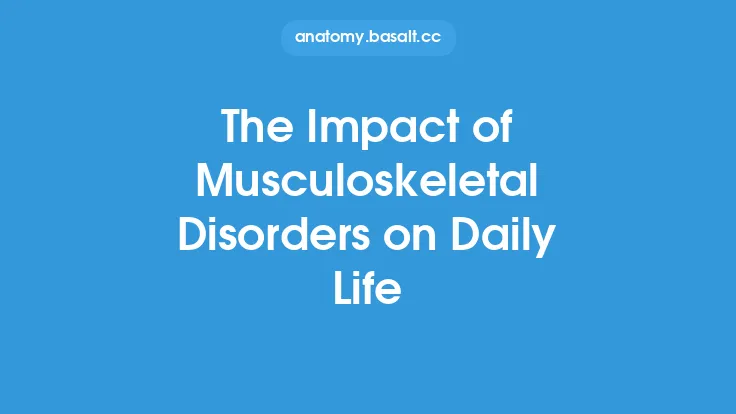 The Impact of Musculoskeletal Disorders on Daily Life Thumbnail