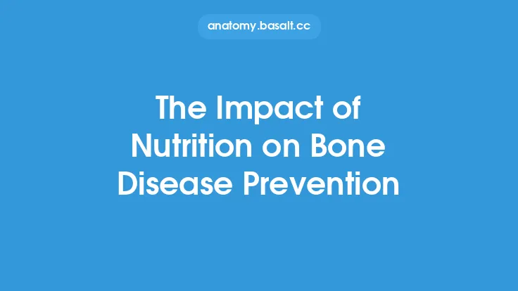The Impact of Nutrition on Bone Disease Prevention Thumbnail
