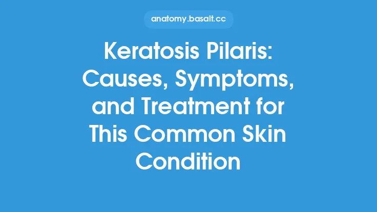 Keratosis Pilaris: Causes, Symptoms, and Treatment for This Common Skin Condition Thumbnail