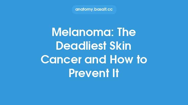 Melanoma: The Deadliest Skin Cancer and How to Prevent It Thumbnail
