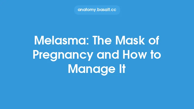 Melasma: The Mask of Pregnancy and How to Manage It Thumbnail