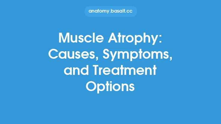 Muscle Atrophy: Causes, Symptoms, and Treatment Options Thumbnail