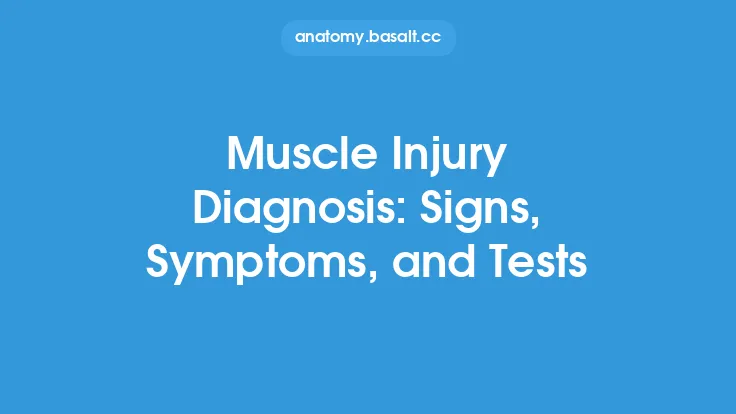 Muscle Injury Diagnosis: Signs, Symptoms, and Tests Thumbnail