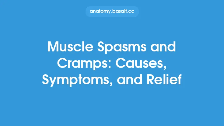 Muscle Spasms and Cramps: Causes, Symptoms, and Relief Thumbnail