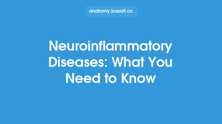 Neuroinflammatory Diseases: What You Need to Know Thumbnail