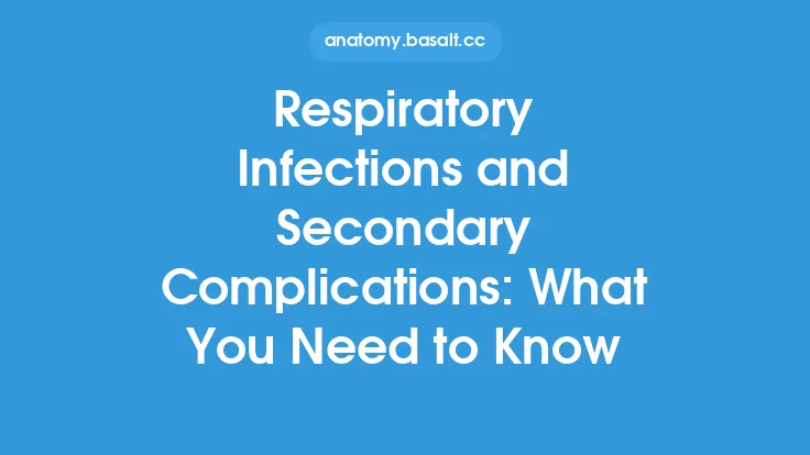 Respiratory Infections and Secondary Complications: What You Need to Know Thumbnail