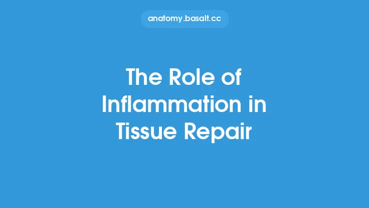 The Role of Inflammation in Tissue Repair Thumbnail