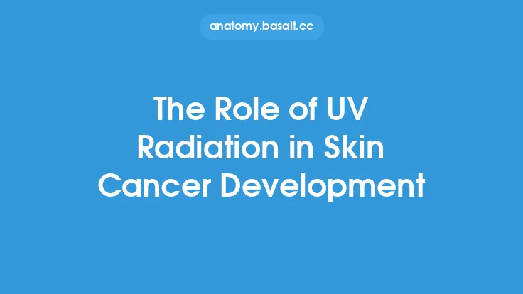 The Role of UV Radiation in Skin Cancer Development Thumbnail