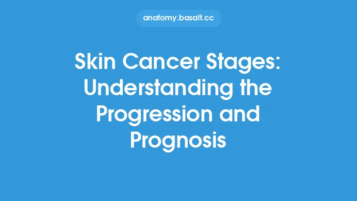 Skin Cancer Stages: Understanding the Progression and Prognosis Thumbnail