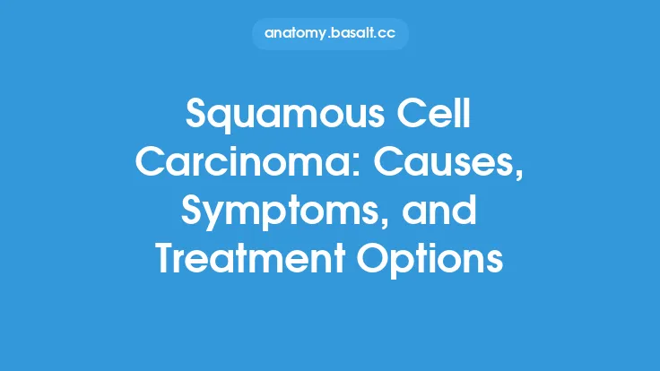 Squamous Cell Carcinoma: Causes, Symptoms, and Treatment Options Thumbnail