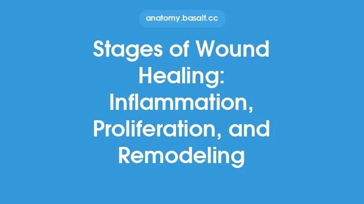 Stages of Wound Healing: Inflammation, Proliferation, and Remodeling Thumbnail