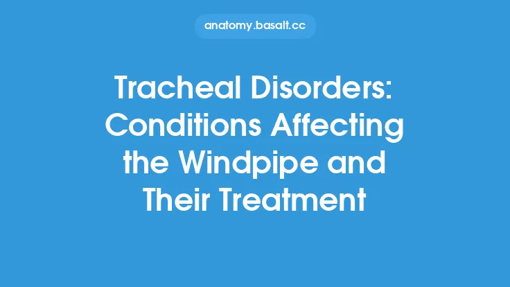 Tracheal Disorders: Conditions Affecting the Windpipe and Their Treatment Thumbnail