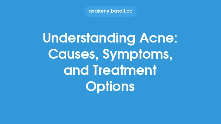 Understanding Acne: Causes, Symptoms, and Treatment Options Thumbnail