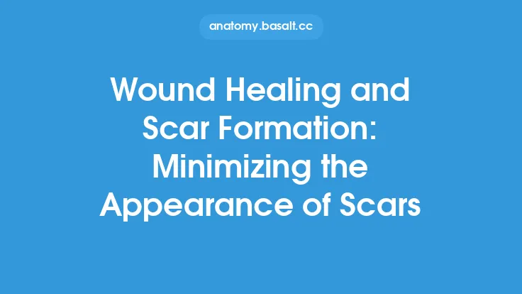Wound Healing and Scar Formation: Minimizing the Appearance of Scars Thumbnail